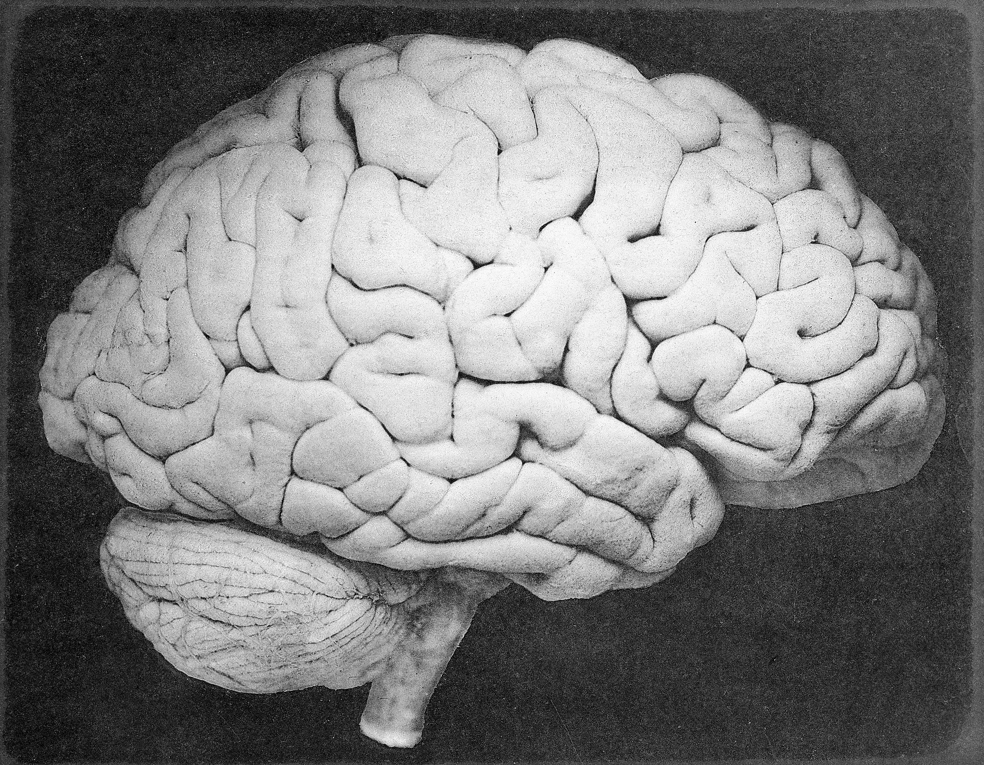 Our Big Brains