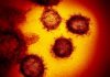 Virus death toll drops to 5 in N.Y., once the U.S. epicenter
