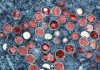 WHO renames monkeypox as mpox, citing racism concerns