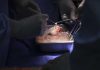 U.S. surgeons transplant a gene-edited pig kidney into a patient for the first time