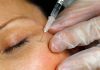 FDA warns websites selling unapproved Botox for cosmetic purposes