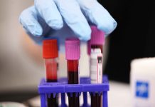 How a new AI blood test is ending the era of “silent” liver disease