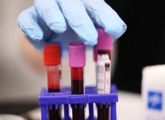 How a new AI blood test is ending the era of “silent” liver disease