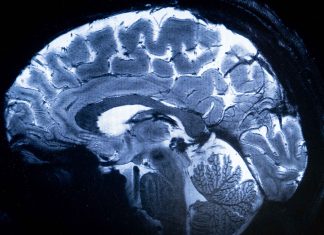 Healing the Mind: Breakthrough in treatment-resistant depression